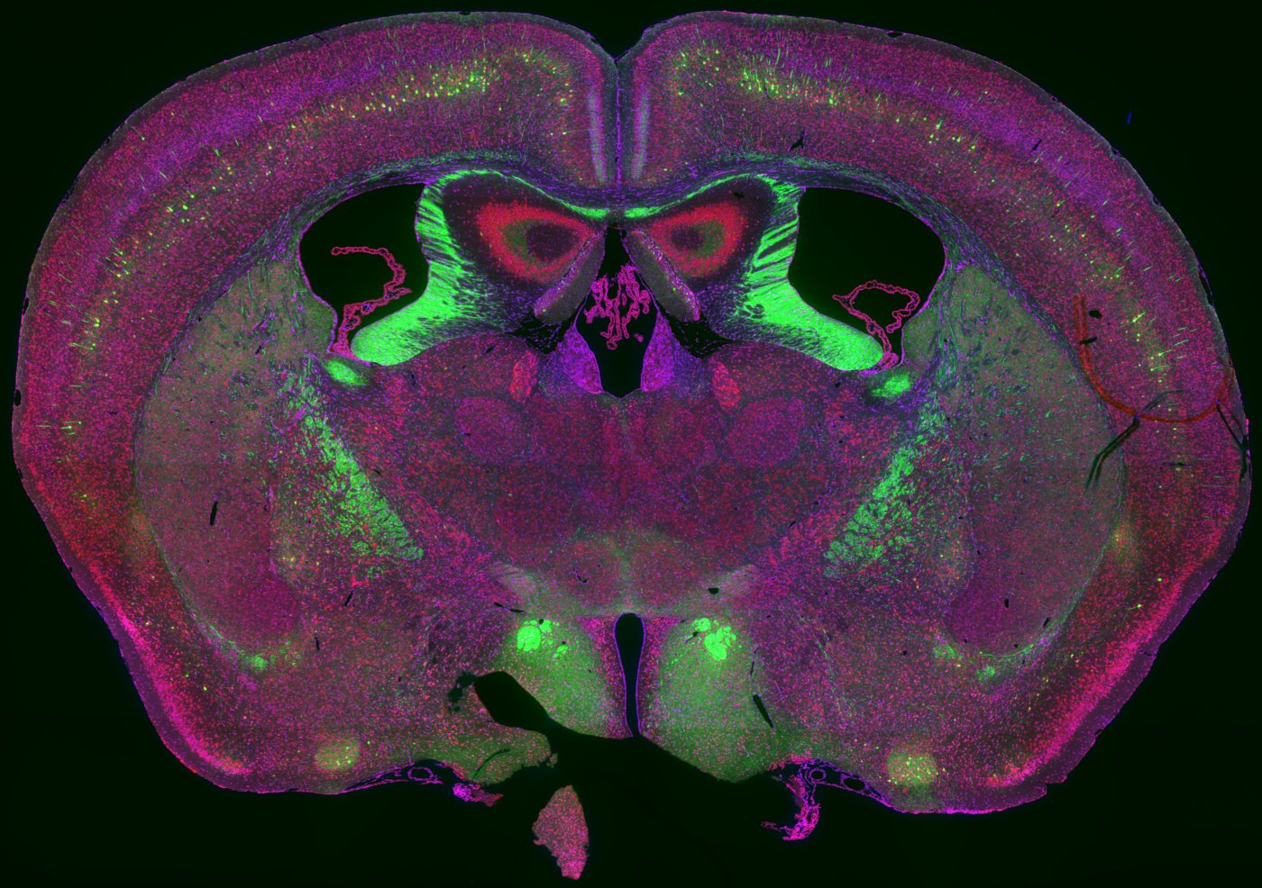 brain.jpg